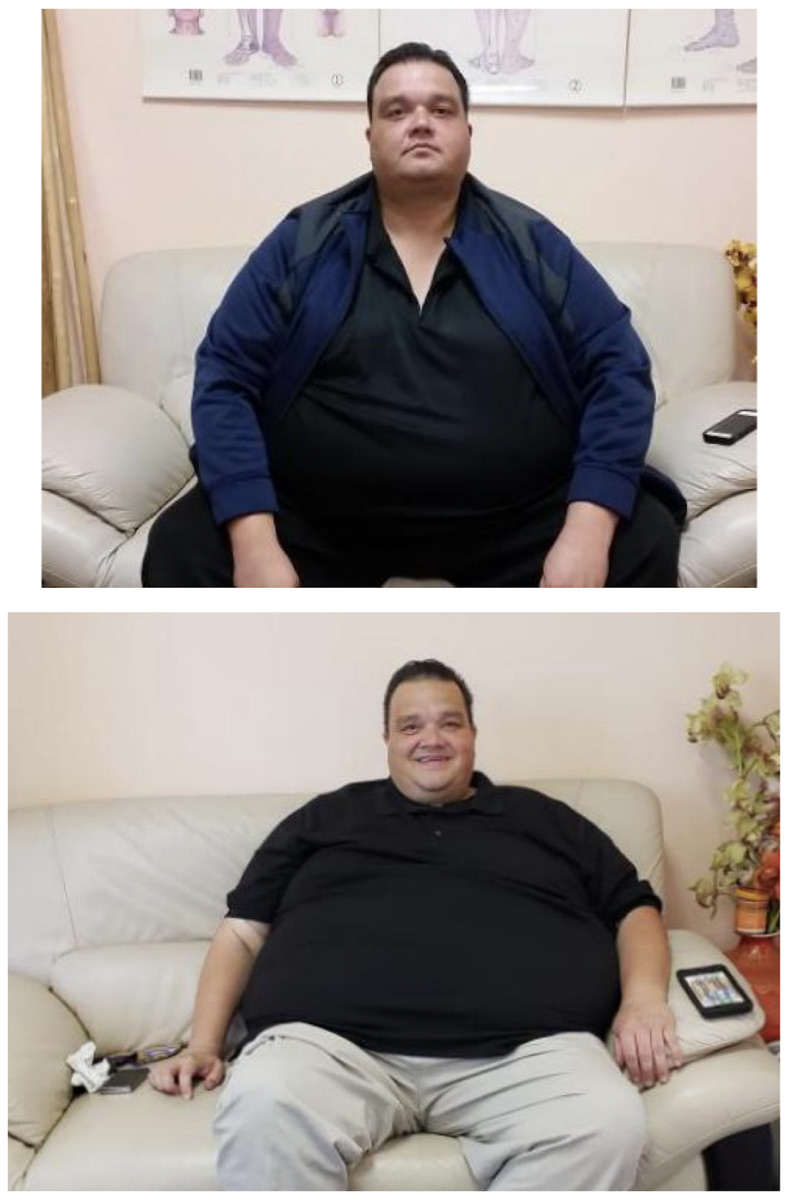 A LittleKnown Way to Healthily Lose Weight TCM Lowers Lipids